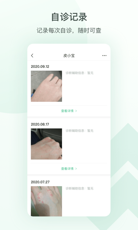 皮小宝 皮小宝