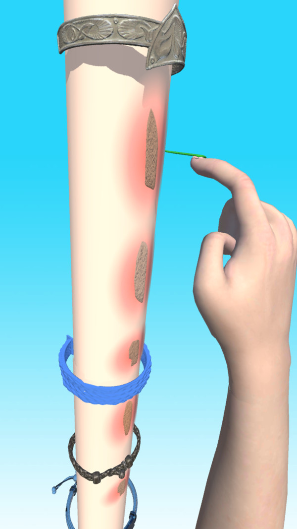疤痕快跑 疤痕快跑